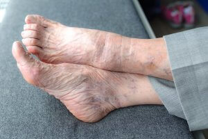 An elderly person's feet